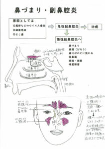 鼻づまり 副鼻腔炎 神奈川県横浜市の漢方薬局 回徳堂薬局