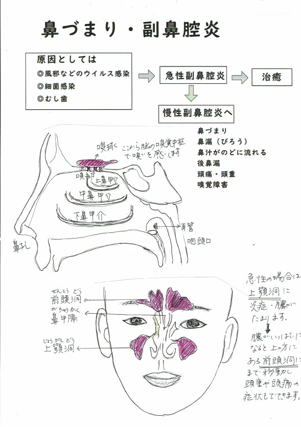 鼻づまり 副鼻腔炎 神奈川県横浜市の漢方薬局 回徳堂薬局